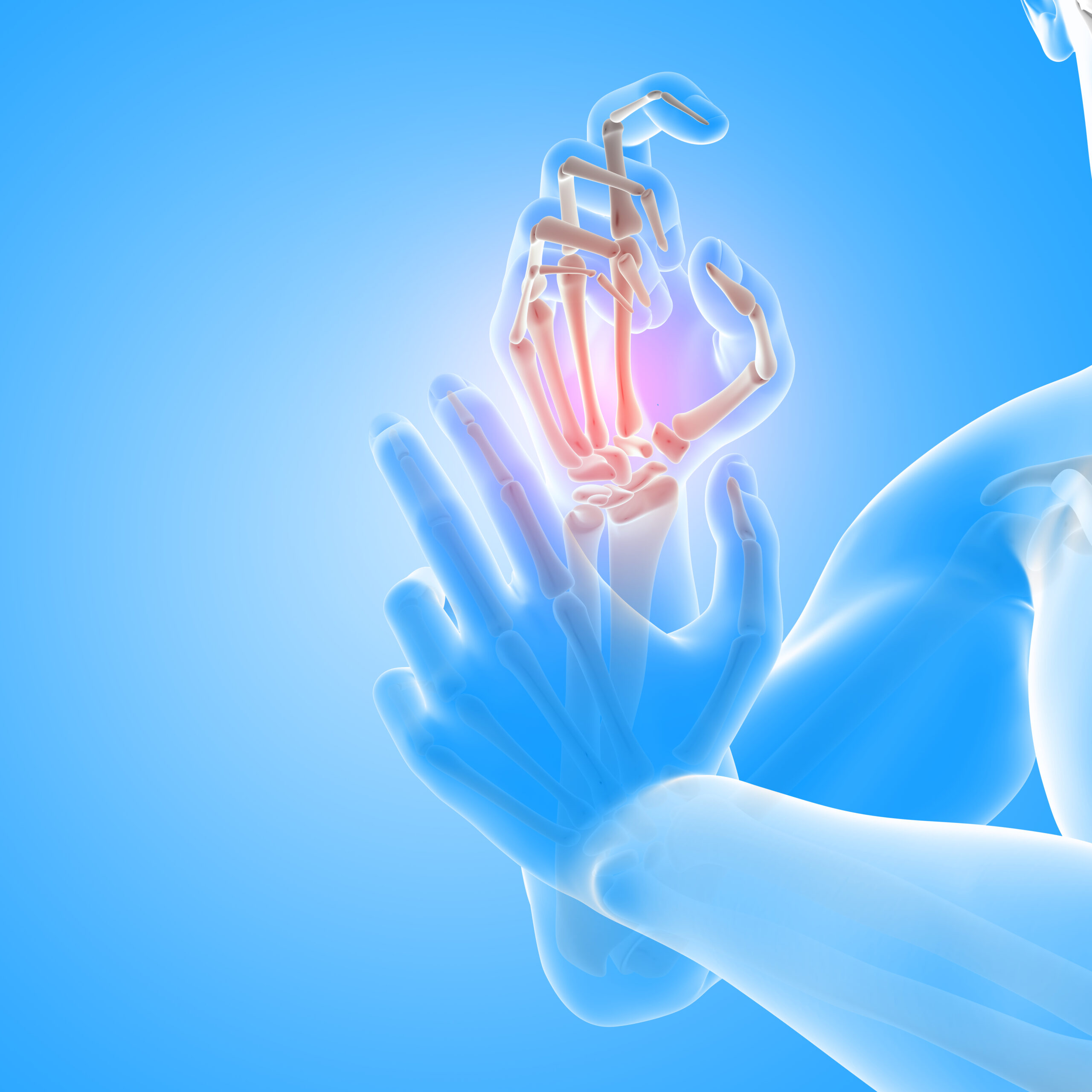 Arthritis treatment